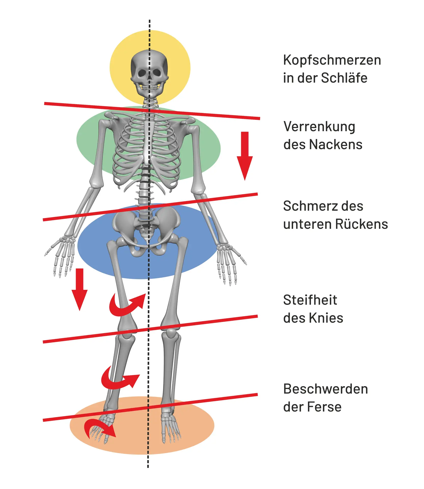 Verspannungsmuster Leber