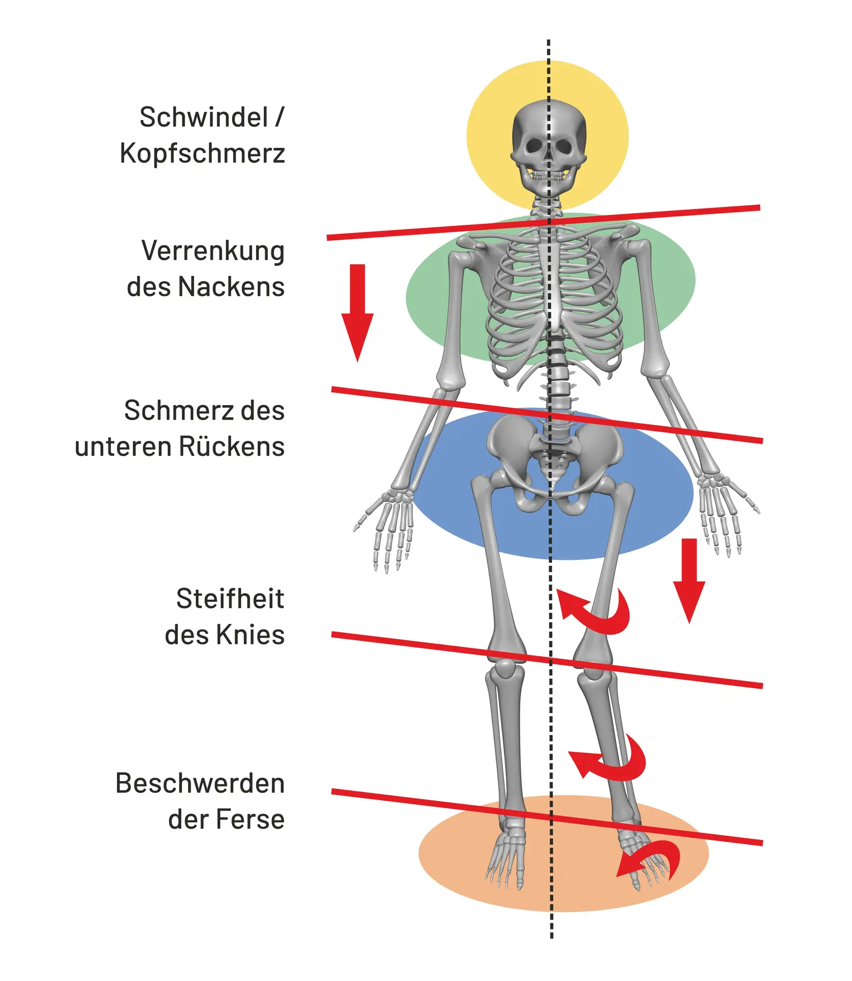 Verspannungsmuster Magen